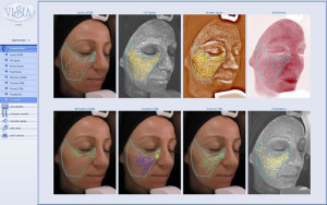 Skin Analysis
